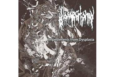 GLOSSECTOMY
