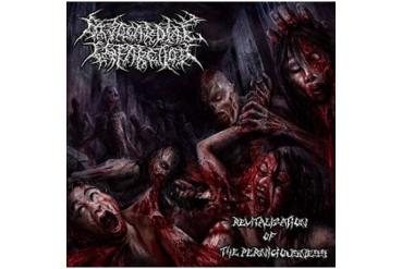 MYOCARDIAL INFARCTION